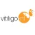 Vitiligo.nl