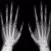Radiography Glossary and Flashcard,Study Guide
