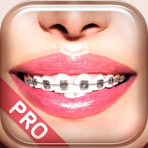 Braces Photo Booth Pro Braces Photo Booth Pro