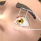 Eye Eye Doc