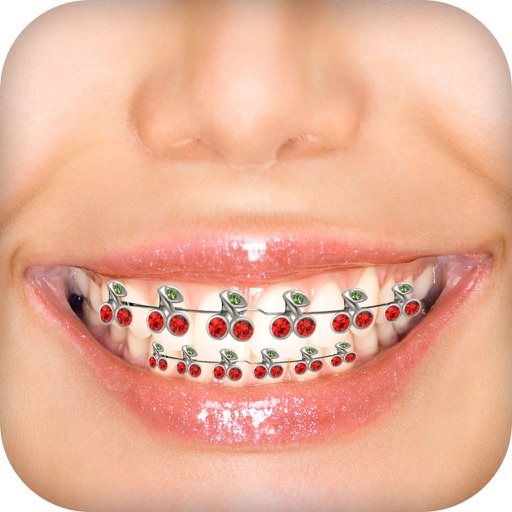 Braces Camera Photo Editor Braces Camera Photo Editor