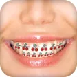 Braces Camera Photo Editor