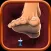 Neuropathy