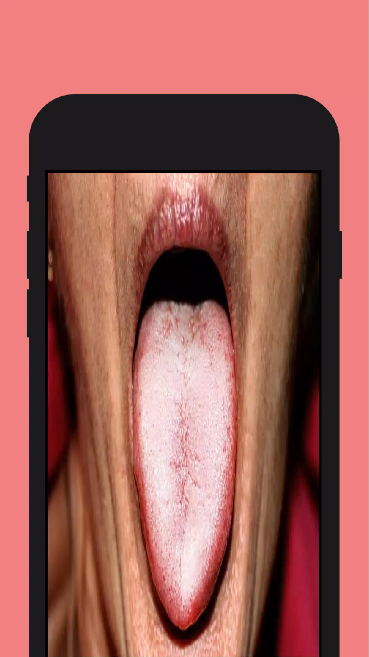 Hiv Signs Screenshots