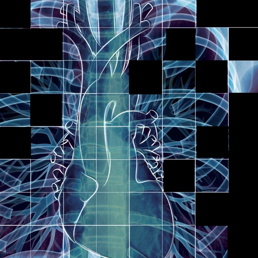 Chest X-ray Interpretation Chest X-ray Interpretation