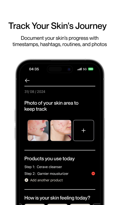 Skin Diary: Track & Glow Screenshots
