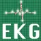 ECG QUIZ START
